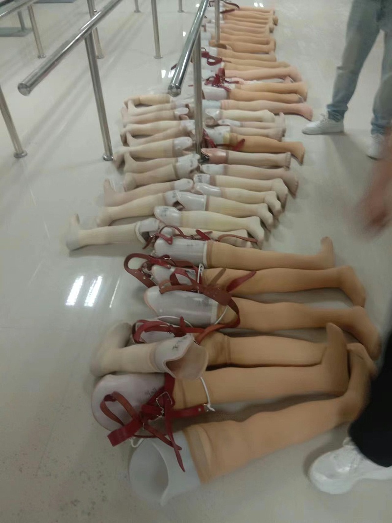 助力殘疾人美好生活丨張家口市殘聯攜手恩德萊開展假肢救助項目