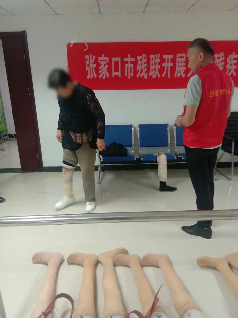 助力殘疾人美好生活丨張家口市殘聯攜手恩德萊開展假肢救助項目